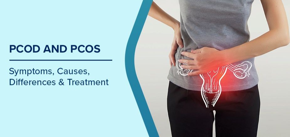 PCOS/PCOD Treatment in Noida