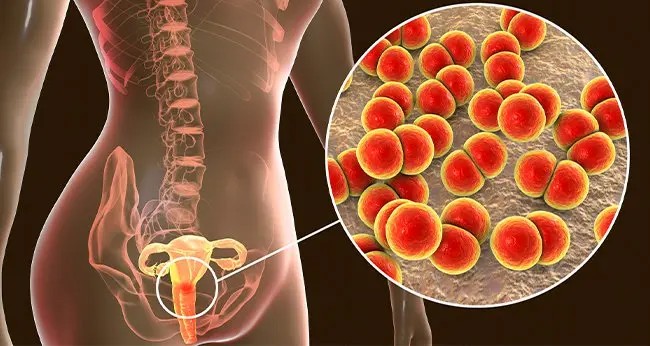 Pelvic Infections Treatment in Noida