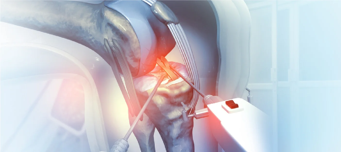 Conventional Knee Replacement in Greater Noida