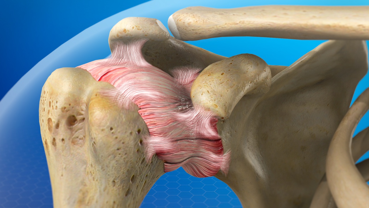 Arthritis Treatment in Greater Noida