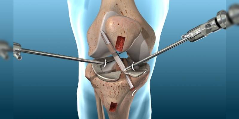 Knee Replacement Surgeon in Greater Noida