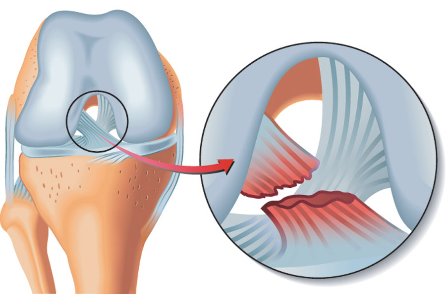 Orthopedic Doctor in Greater Noida