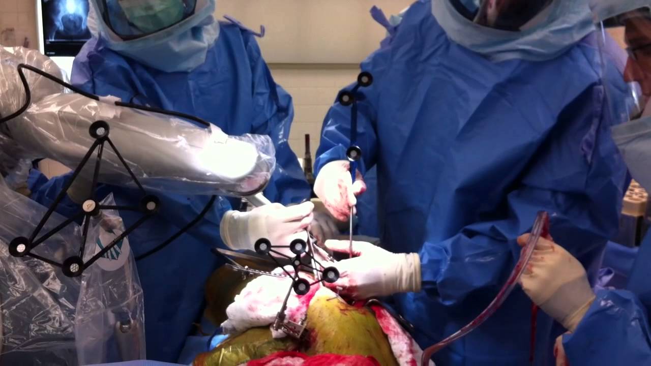 Robotic Hip Replacement in Greater Noida