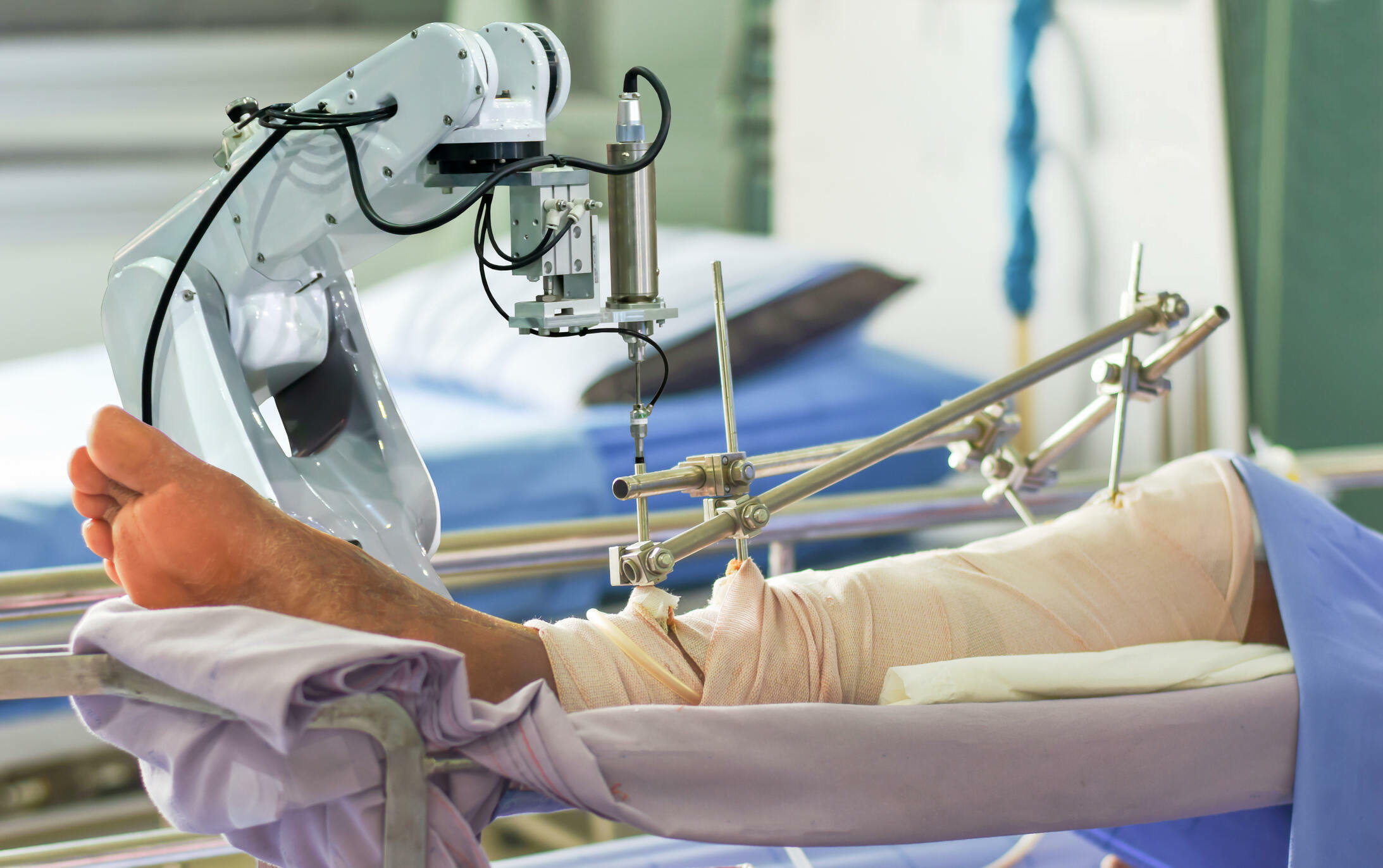 Robotic Knee Replacement in Greater Noida